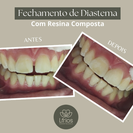 Prévia do Instagram